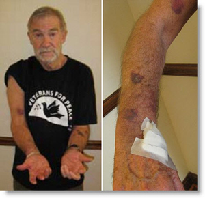 Ray McGovern injuries